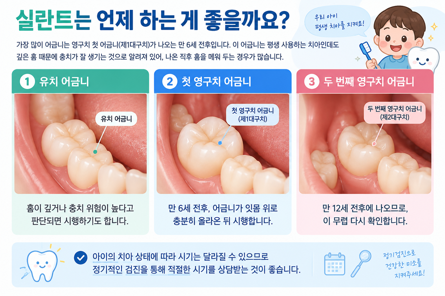실란트 진행 과정 - 성남 산성역 연세꿈꾸는아이치과